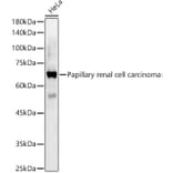 Western Blot - Anti-Papillary renal cell carcinoma Antibody (A309437) - Antibodies.com