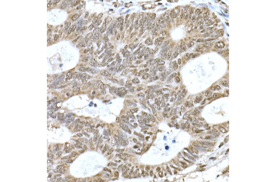 Immunohistochemistry - Anti-PI3 Kinase p110 beta Antibody [ARC0703] (A309440) - Antibodies.com