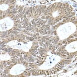 Immunohistochemistry - Anti-PI3 Kinase p110 beta Antibody [ARC0703] (A309440) - Antibodies.com