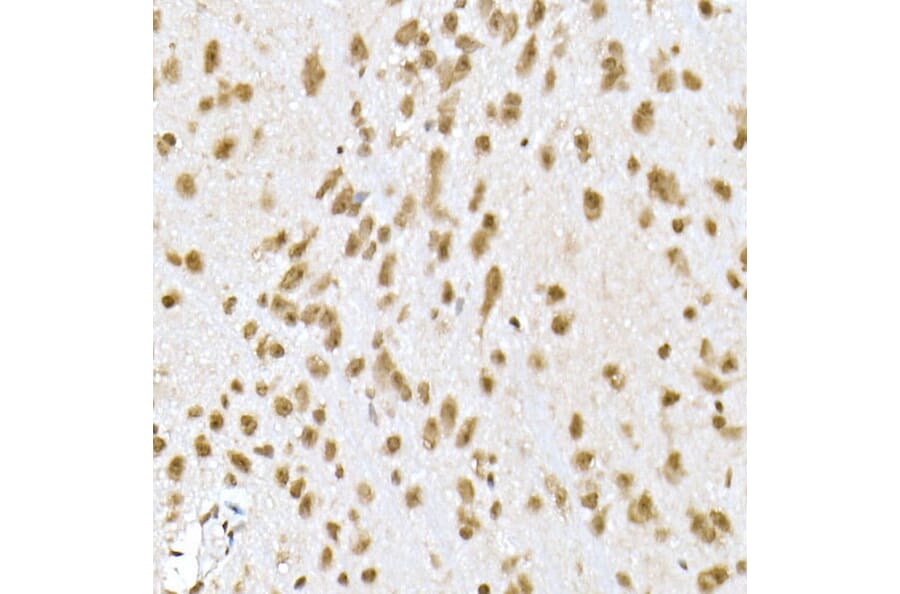 Immunohistochemistry - Anti-PI3 Kinase p110 beta Antibody [ARC0703] (A309440) - Antibodies.com