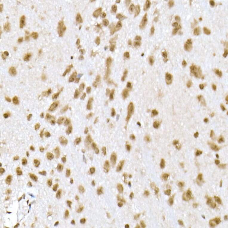 Immunohistochemistry - Anti-PI3 Kinase p110 beta Antibody [ARC0703] (A309440) - Antibodies.com