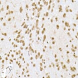 Immunohistochemistry - Anti-PI3 Kinase p110 beta Antibody [ARC0703] (A309440) - Antibodies.com