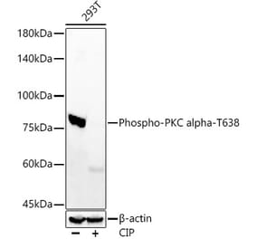 Western Blot - Anti-PKC alpha (phospho Thr638) Antibody [ARC58020] (A309441) - Antibodies.com