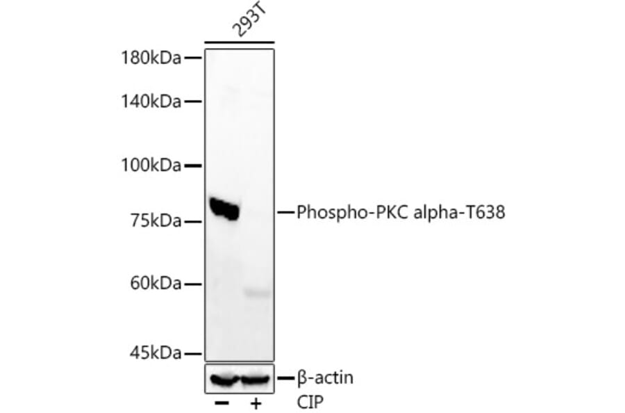 Western Blot - Anti-PKC alpha (phospho Thr638) Antibody [ARC58020] (A309441) - Antibodies.com