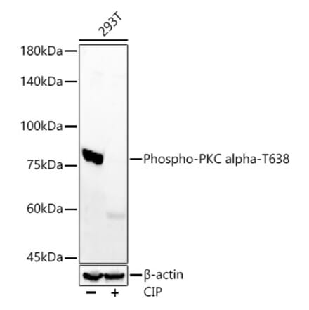 Western Blot - Anti-PKC alpha (phospho Thr638) Antibody [ARC58020] (A309441) - Antibodies.com