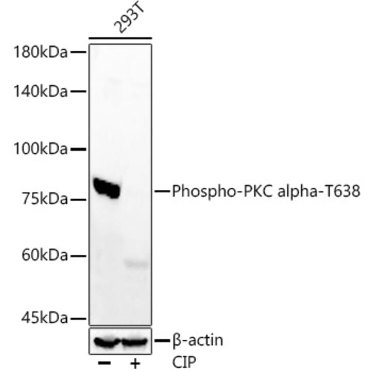 Western Blot - Anti-PKC alpha (phospho Thr638) Antibody [ARC58020] (A309441) - Antibodies.com