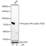 Western Blot - Anti-PKC alpha (phospho Thr638) Antibody [ARC58020] (A309441) - Antibodies.com