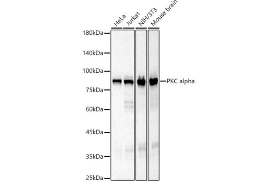 Western Blot - Anti-PKC alpha Antibody [ARC58853] (A309442) - Antibodies.com