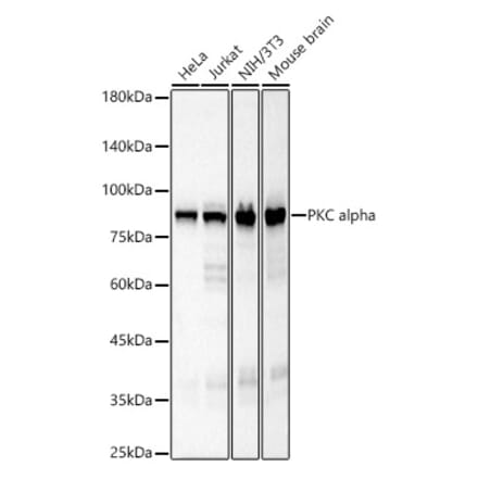 Western Blot - Anti-PKC alpha Antibody [ARC58853] (A309442) - Antibodies.com