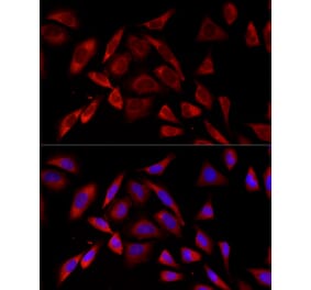 Immunofluorescence - Anti-PKC alpha Antibody [ARC58845] (A309443) - Antibodies.com