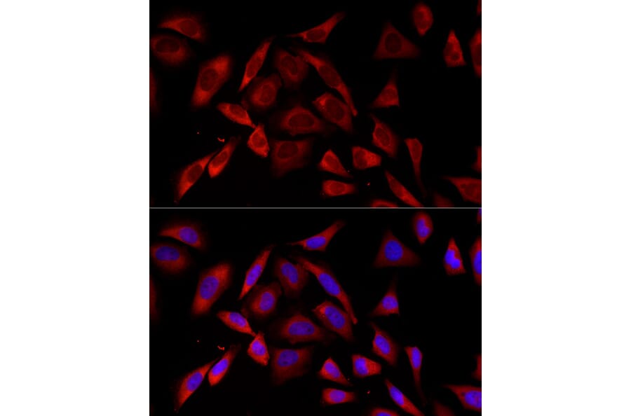 Immunofluorescence - Anti-PKC alpha Antibody [ARC58845] (A309443) - Antibodies.com