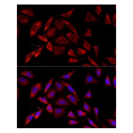 Immunofluorescence - Anti-PKC alpha Antibody [ARC58845] (A309443) - Antibodies.com