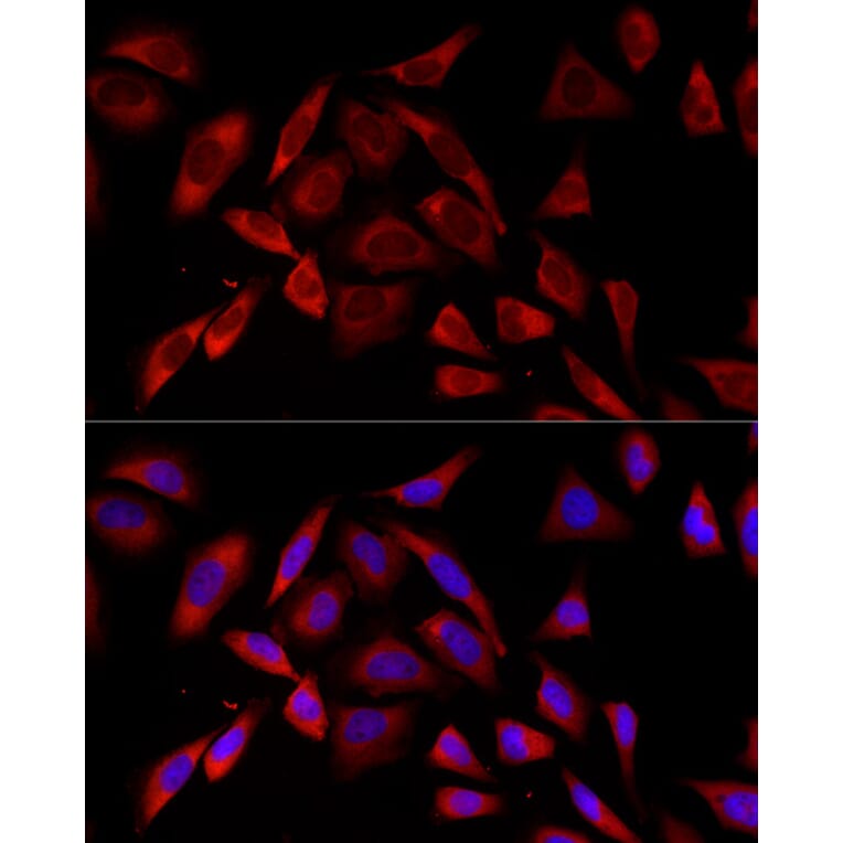 Immunofluorescence - Anti-PKC alpha Antibody [ARC58845] (A309443) - Antibodies.com
