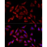 Immunofluorescence - Anti-PKC alpha Antibody [ARC58845] (A309443) - Antibodies.com