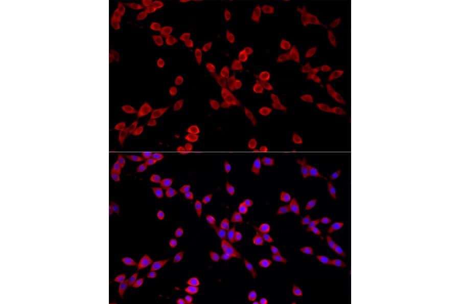 Immunofluorescence - Anti-PKC alpha Antibody [ARC58845] (A309443) - Antibodies.com