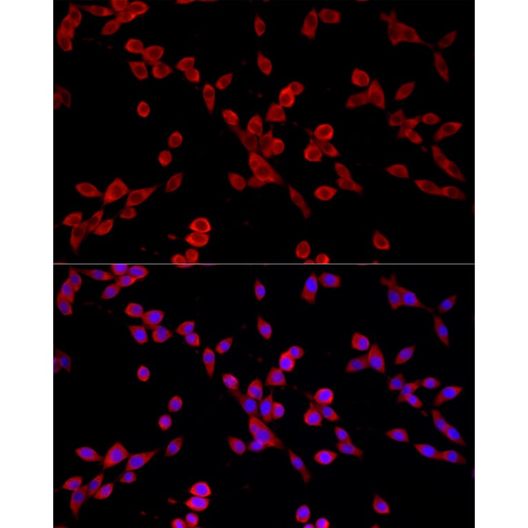 Immunofluorescence - Anti-PKC alpha Antibody [ARC58845] (A309443) - Antibodies.com
