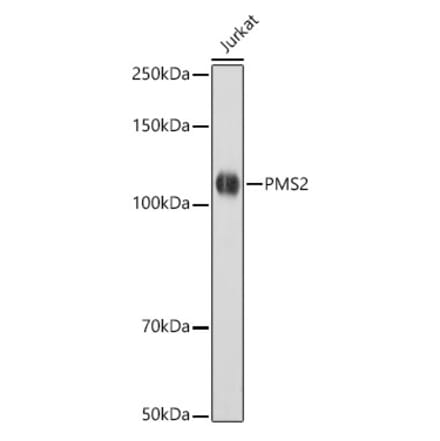 Western Blot - Anti-PMS2 Antibody [ARC2479] (A309444) - Antibodies.com