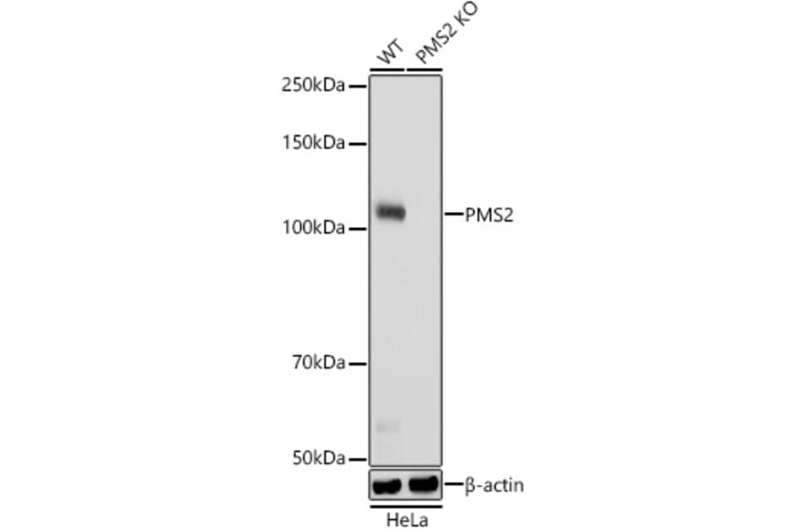Western Blot - Anti-PMS2 Antibody [ARC2479] (A309444) - Antibodies.com