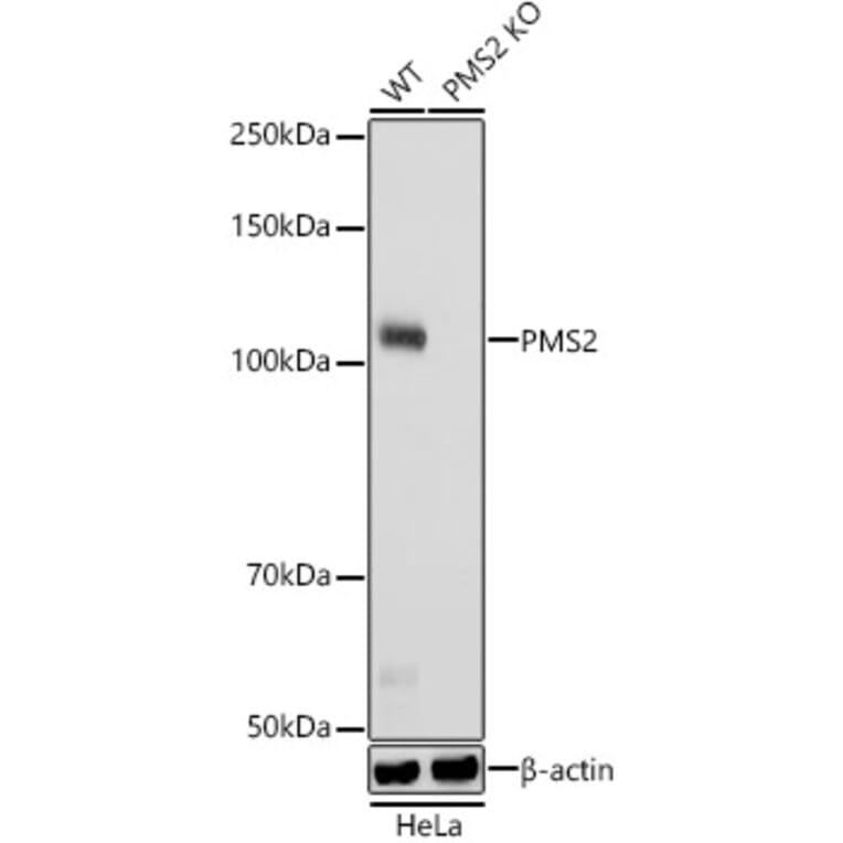 Western Blot - Anti-PMS2 Antibody [ARC2479] (A309444) - Antibodies.com