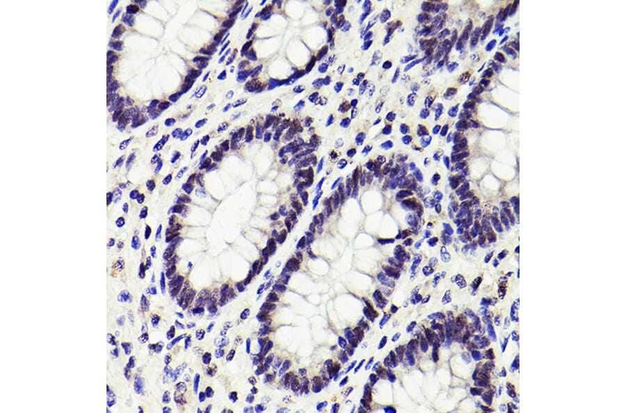 Immunohistochemistry - Anti-PMS2 Antibody [ARC2479] (A309444) - Antibodies.com