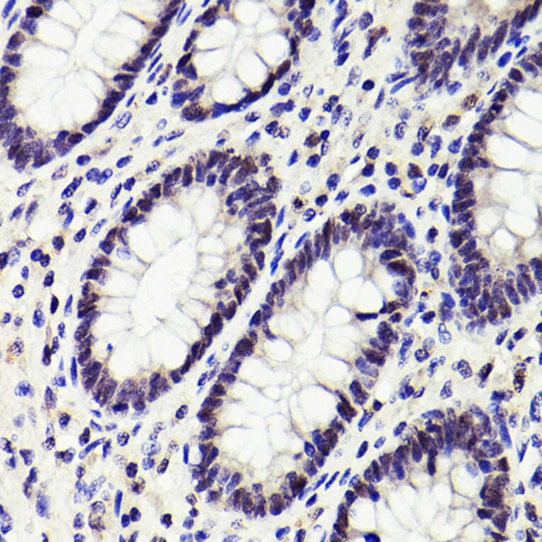 Immunohistochemistry - Anti-PMS2 Antibody [ARC2479] (A309444) - Antibodies.com