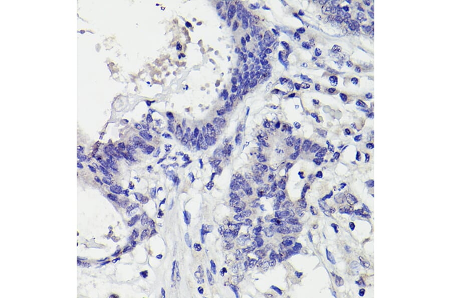 Immunohistochemistry - Anti-PMS2 Antibody [ARC2479] (A309444) - Antibodies.com