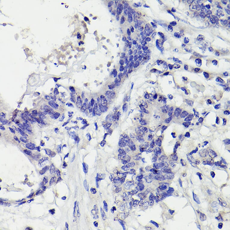 Immunohistochemistry - Anti-PMS2 Antibody [ARC2479] (A309444) - Antibodies.com