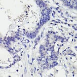 Immunohistochemistry - Anti-PMS2 Antibody [ARC2479] (A309444) - Antibodies.com