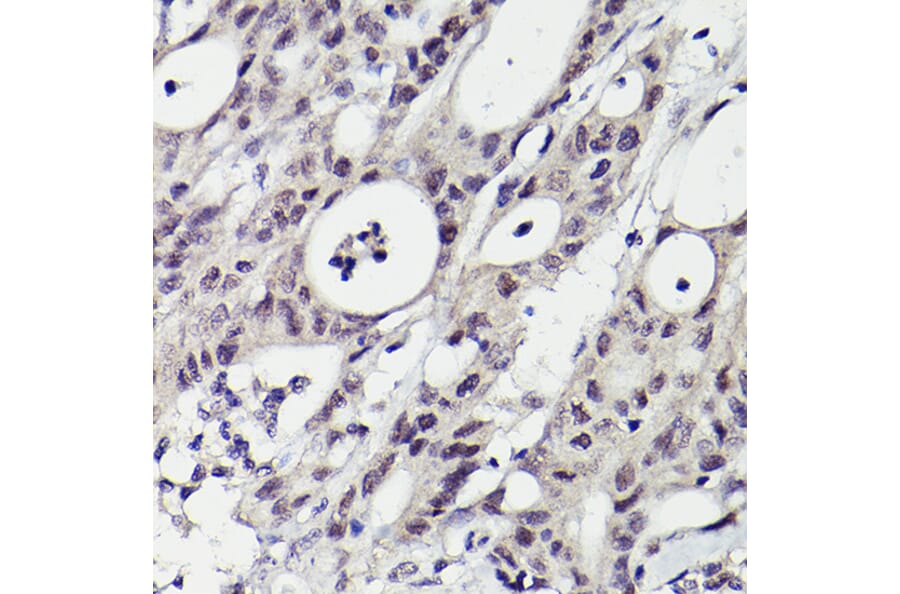 Immunohistochemistry - Anti-PMS2 Antibody [ARC2479] (A309444) - Antibodies.com