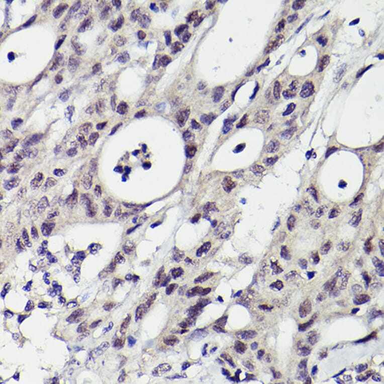 Immunohistochemistry - Anti-PMS2 Antibody [ARC2479] (A309444) - Antibodies.com