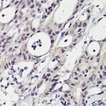 Immunohistochemistry - Anti-PMS2 Antibody [ARC2479] (A309444) - Antibodies.com