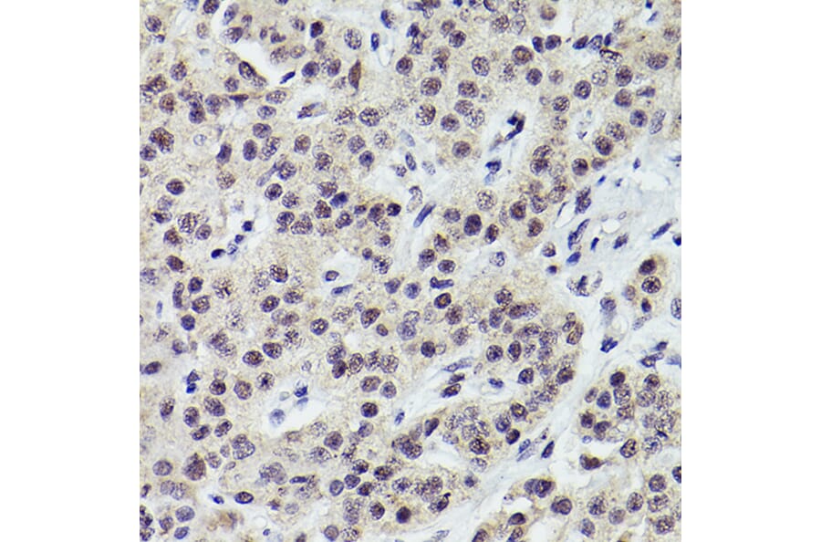 Immunohistochemistry - Anti-PMS2 Antibody [ARC2479] (A309444) - Antibodies.com