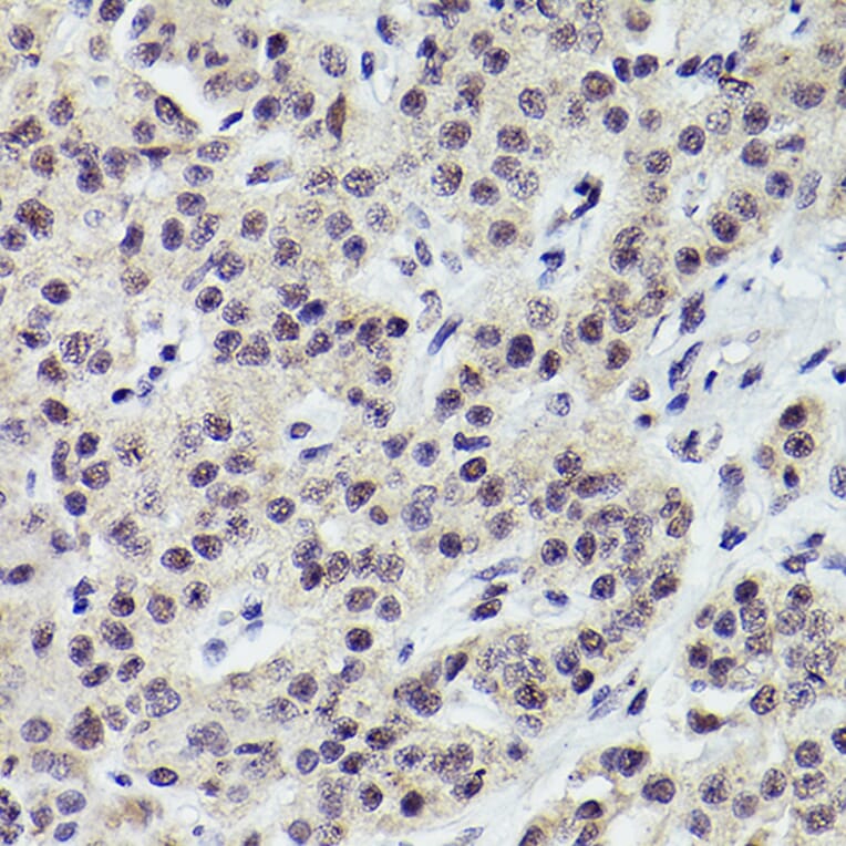Immunohistochemistry - Anti-PMS2 Antibody [ARC2479] (A309444) - Antibodies.com