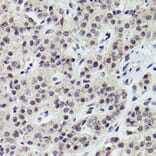Immunohistochemistry - Anti-PMS2 Antibody [ARC2479] (A309444) - Antibodies.com