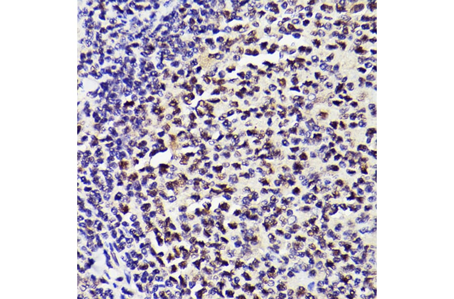 Immunohistochemistry - Anti-PMS2 Antibody [ARC2479] (A309444) - Antibodies.com