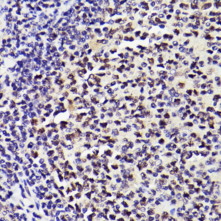 Immunohistochemistry - Anti-PMS2 Antibody [ARC2479] (A309444) - Antibodies.com
