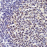 Immunohistochemistry - Anti-PMS2 Antibody [ARC2479] (A309444) - Antibodies.com