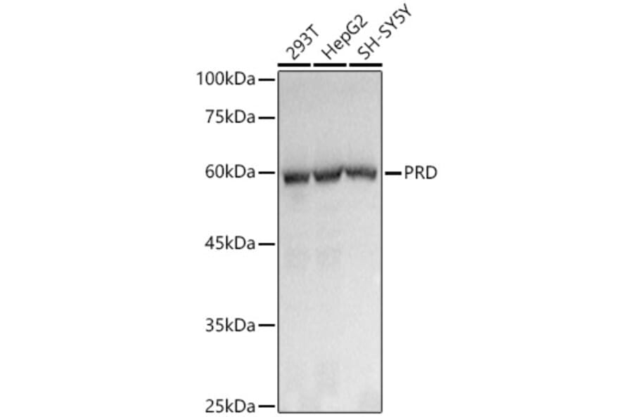 Western Blot - Anti-PRD Antibody [ARC3002] (A309445) - Antibodies.com