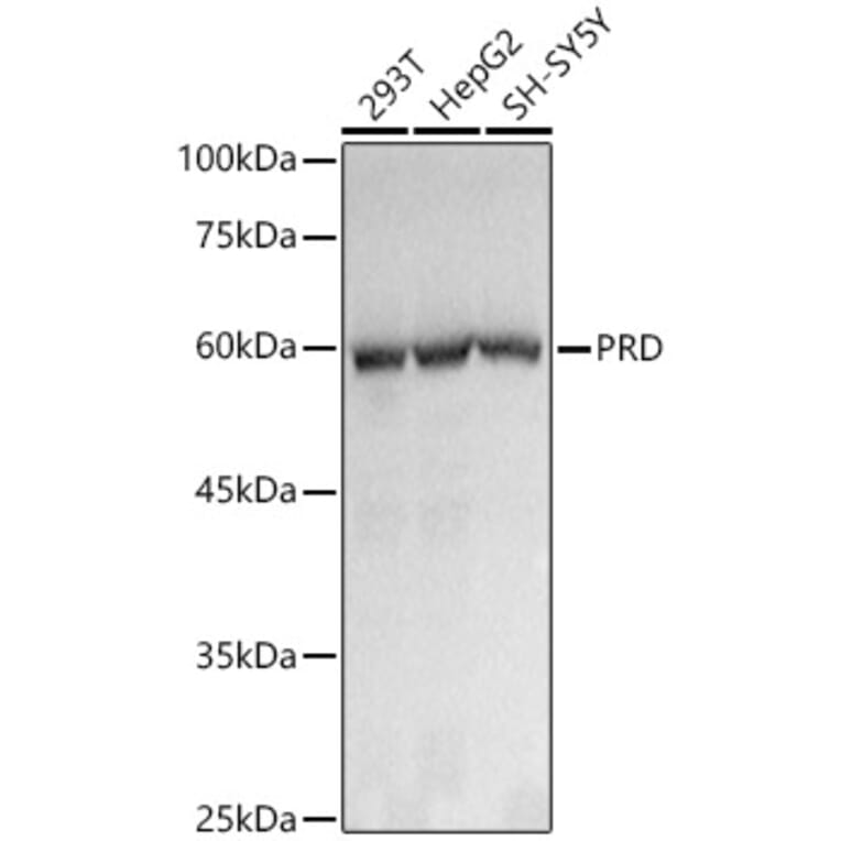 Western Blot - Anti-PRD Antibody [ARC3002] (A309445) - Antibodies.com