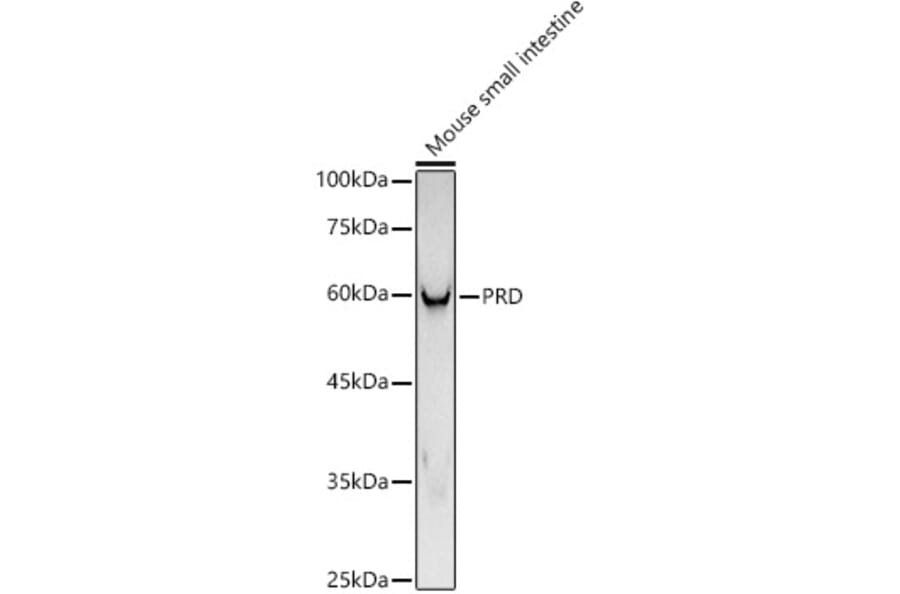 Western Blot - Anti-PRD Antibody [ARC3002] (A309445) - Antibodies.com