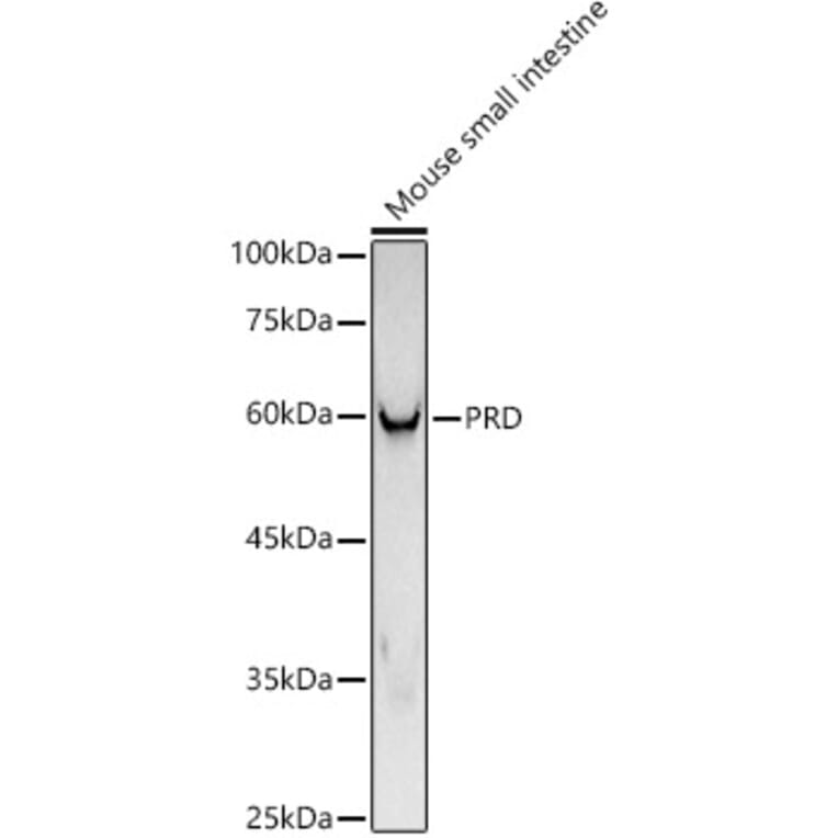 Western Blot - Anti-PRD Antibody [ARC3002] (A309445) - Antibodies.com