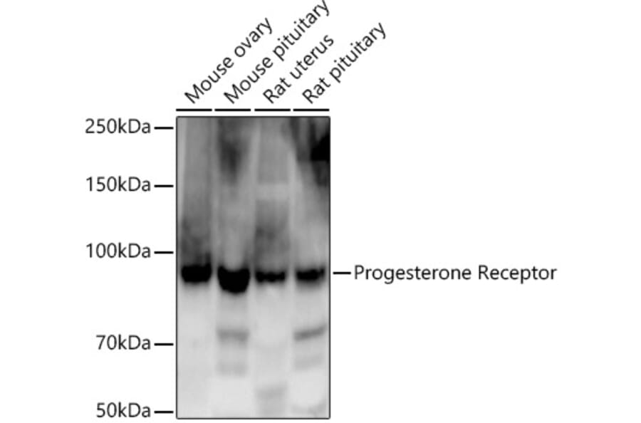 Western Blot - Anti-Progesterone Receptor Antibody [ARC5121-01] (A309446) - Antibodies.com