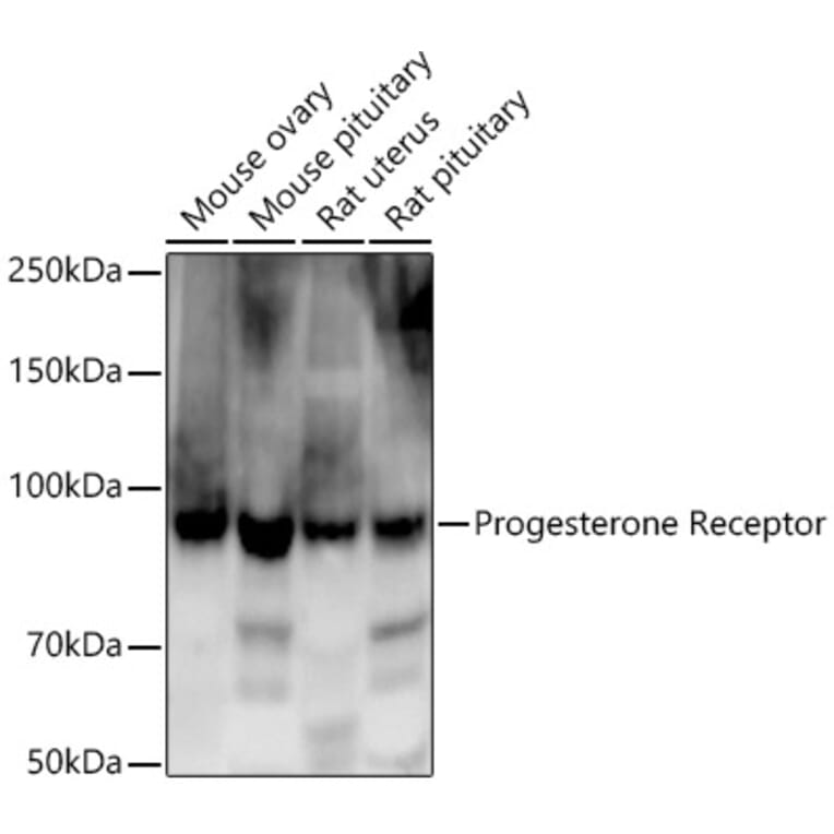Western Blot - Anti-Progesterone Receptor Antibody [ARC5121-01] (A309446) - Antibodies.com