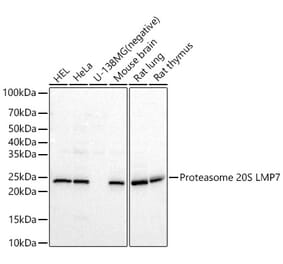 Western Blot - Anti-Proteasome 20S LMP7 Antibody (A309447) - Antibodies.com