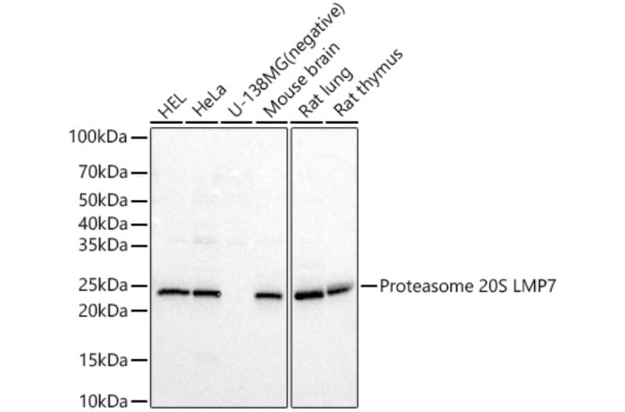 Western Blot - Anti-Proteasome 20S LMP7 Antibody (A309447) - Antibodies.com