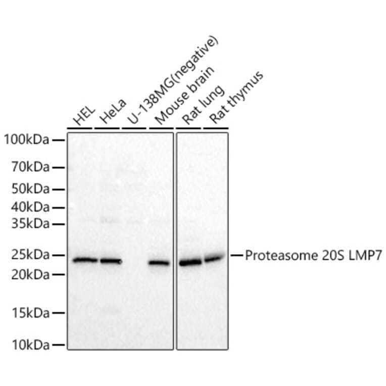 Western Blot - Anti-Proteasome 20S LMP7 Antibody (A309447) - Antibodies.com