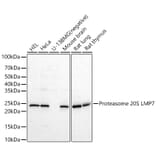 Western Blot - Anti-Proteasome 20S LMP7 Antibody (A309447) - Antibodies.com