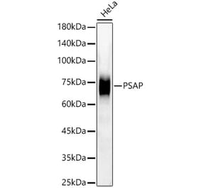 Western Blot - Anti-PSAP Antibody [ARC58322] (A309449) - Antibodies.com