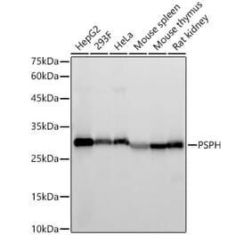 Western Blot - Anti-PSPH Antibody [ARC59122] (A309450) - Antibodies.com