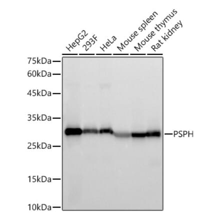 Western Blot - Anti-PSPH Antibody [ARC59122] (A309450) - Antibodies.com